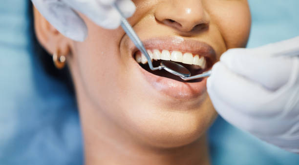 Best Same-Day Emergency Dentist in Jones Valley, CA